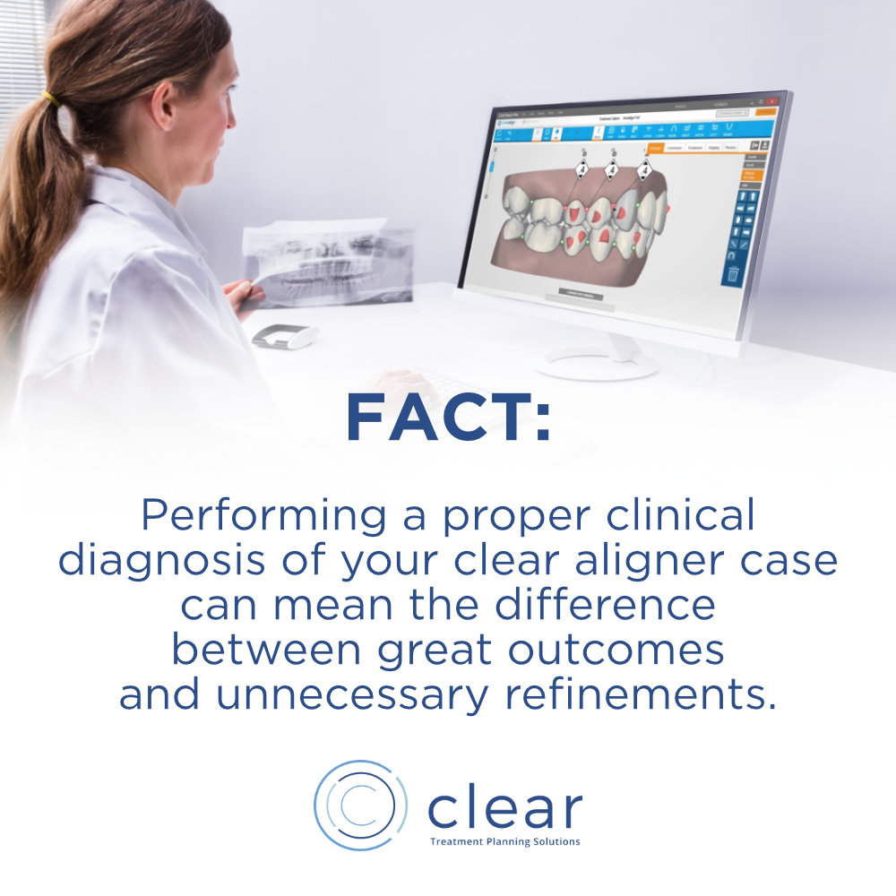 A Clinical Diagnosis of Your Clear Aligner Case is the First Step in Great Outcomes